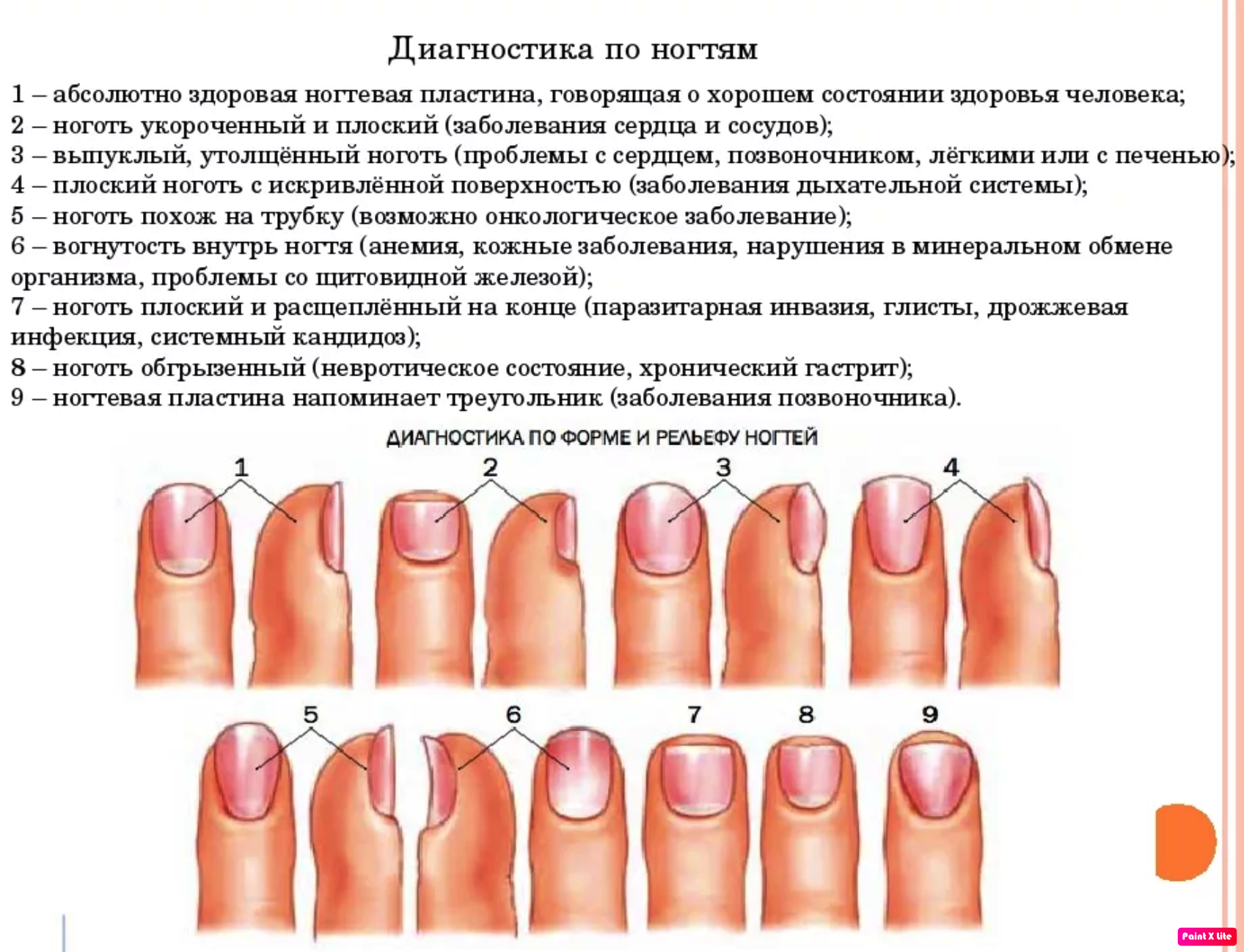 Форма ногтей у женщин о чем говорит на руках фото