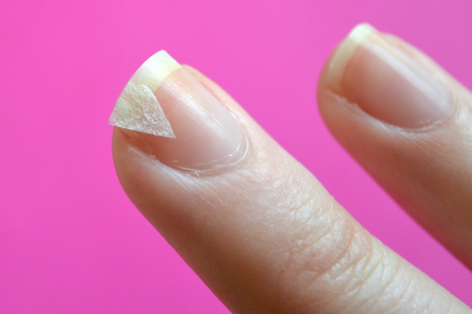 Почему ногти становятся тонкими