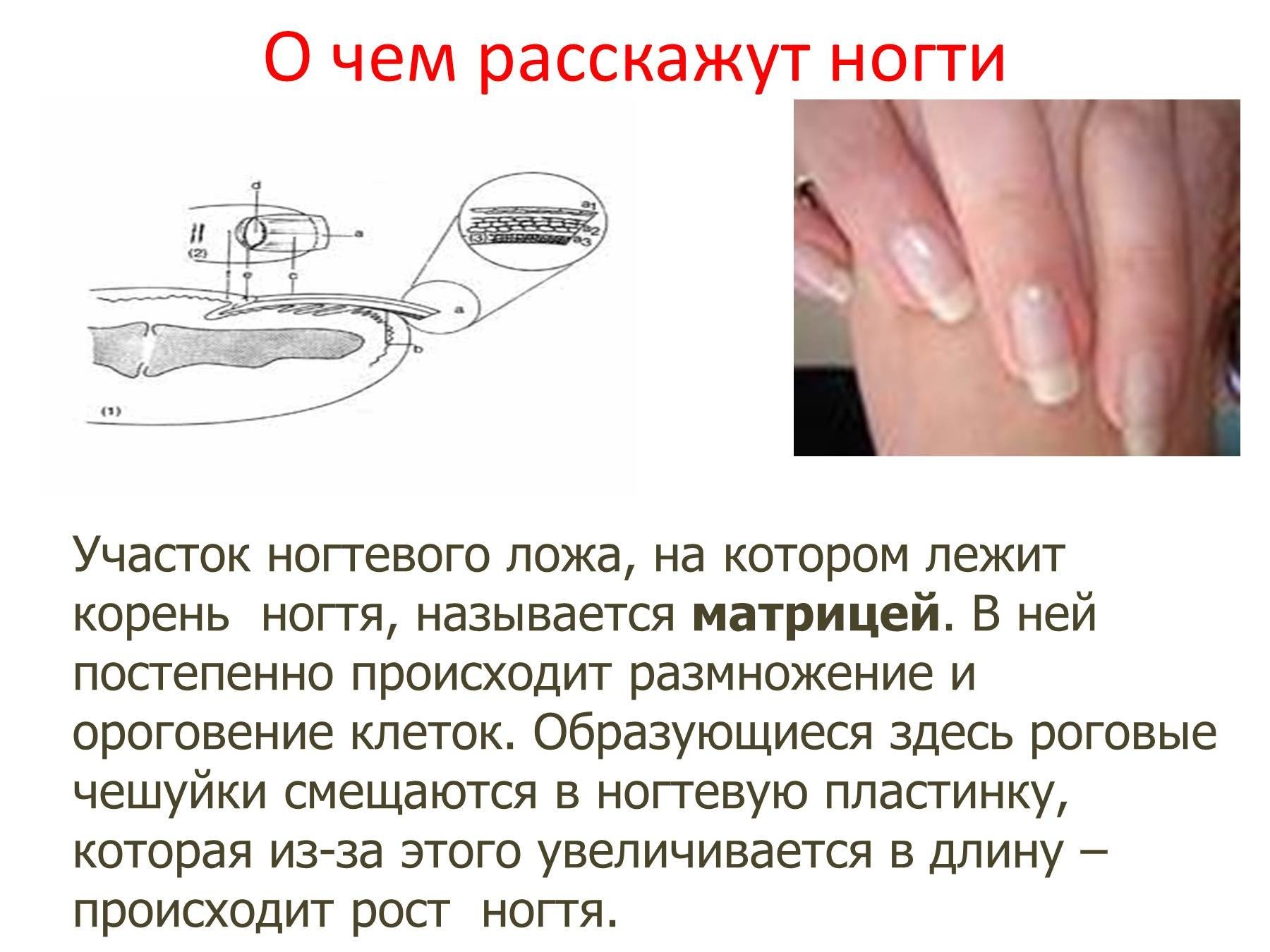 Ногти строение и функции. Ногтевое ложе. Строение ногтевого аппарата. Строение ногтя для мастера по маникюру. Изменение формы ногтей