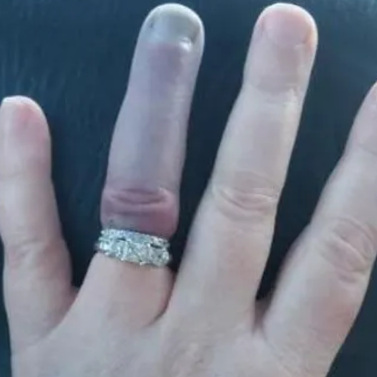 Обручальное кольцо на пальце. Маленькое Кол ур на пальце.