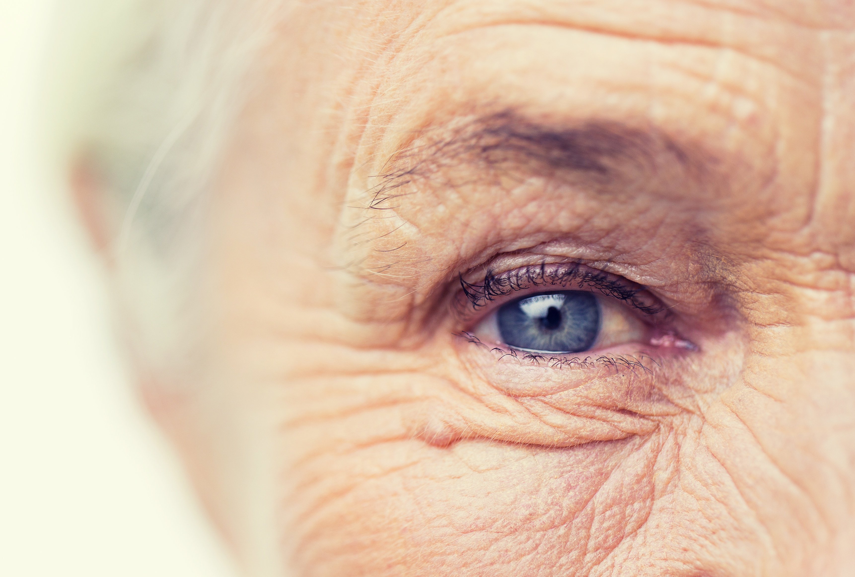 Голодов зрение. Старческая ядерная катаракта. Сенильная катаракта глаза. Глаза пожилого человека.