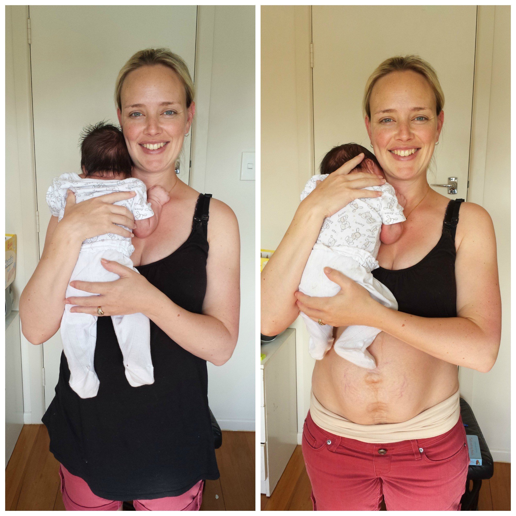 грудь после беременности и родов фото до и после фото 53