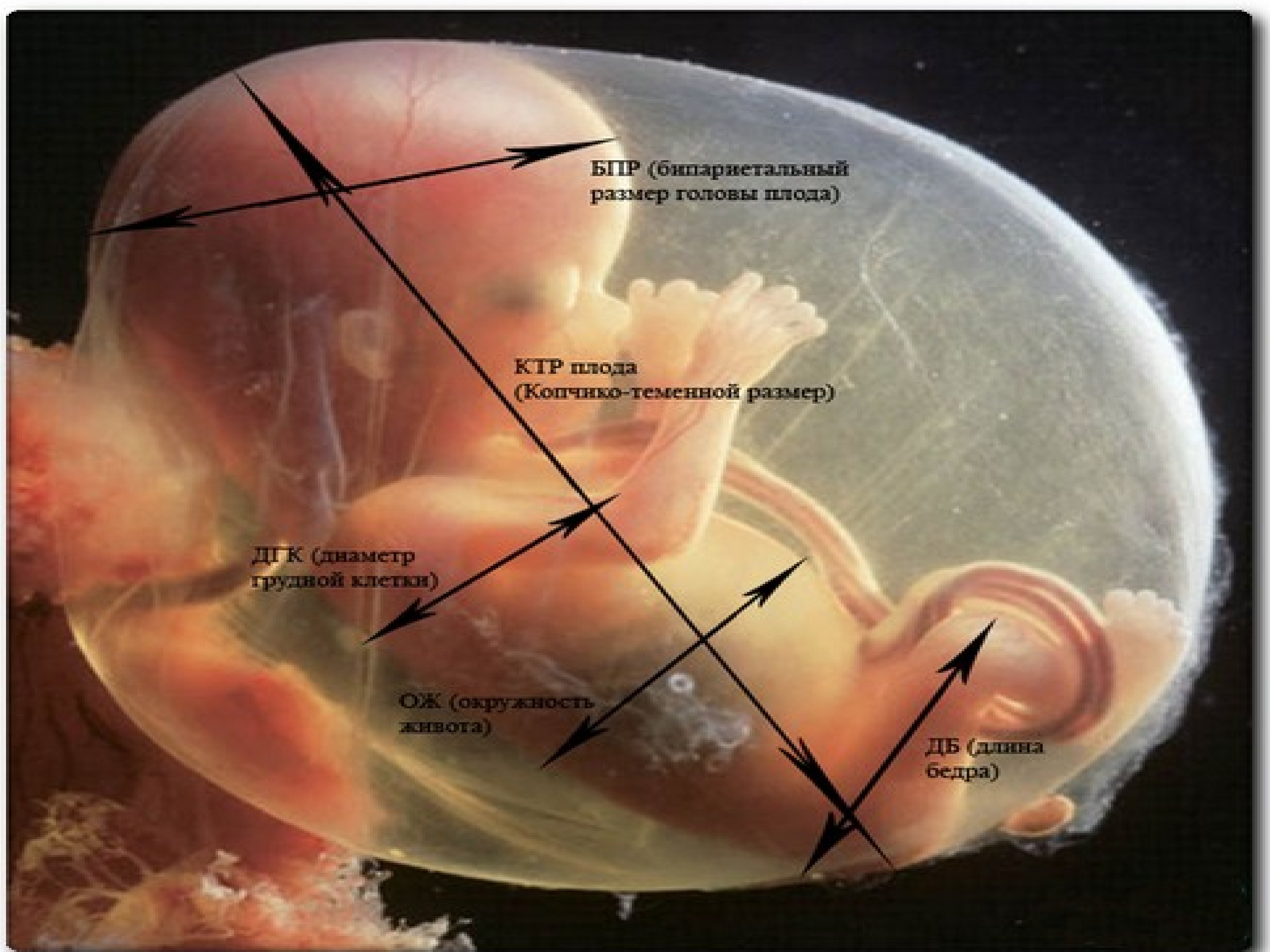 Ктр на 6 неделе. Копчико-теменной размер. КТР плода. КТР эмбриона. КТР 14 недель.