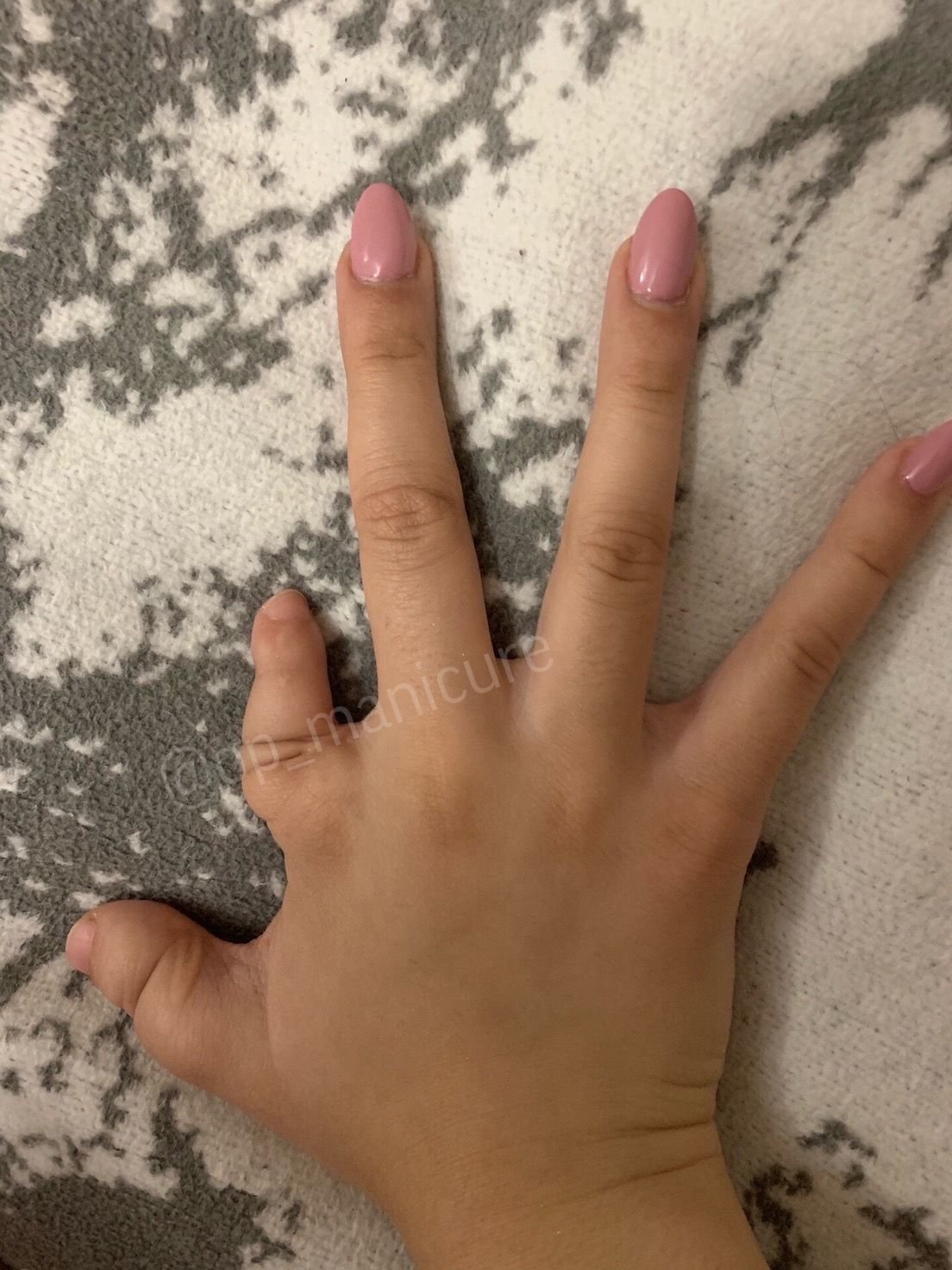 Необычные формы пальцев