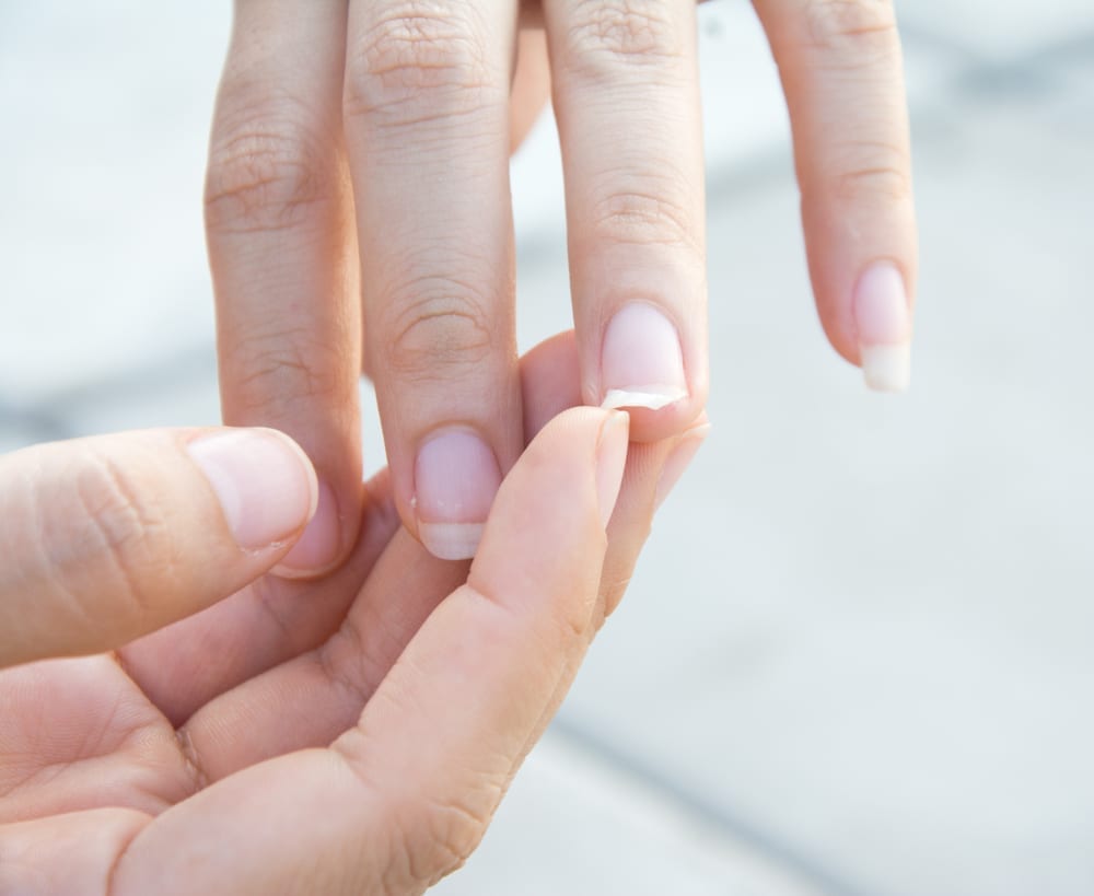 Лейконихия белые пятна на ногтях. Ногти слоятся что делать в домашних условиях