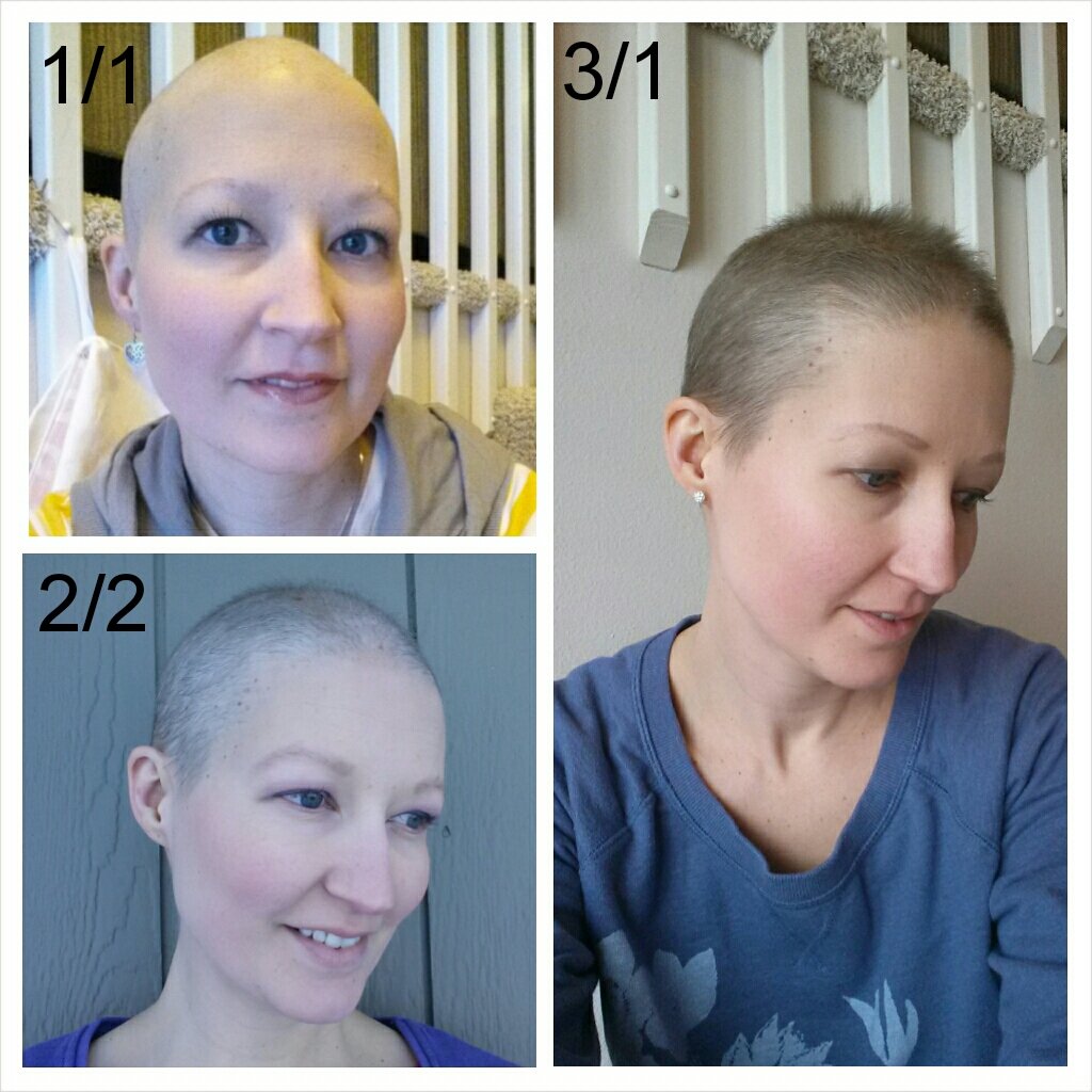 После химии как восстановить. Стрижки после химиотерапии. Волосы после химиотерапии. Отросшие волосы после химиотерапии. Стрижки на отросшие волосы после химиотерапии.