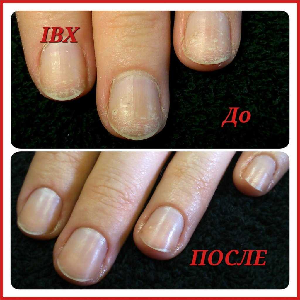 IBX System ногти до и после. IBX система для ногтей до и после. IBX для ногтей до и после. Восстановление ногтей после гель лака средства